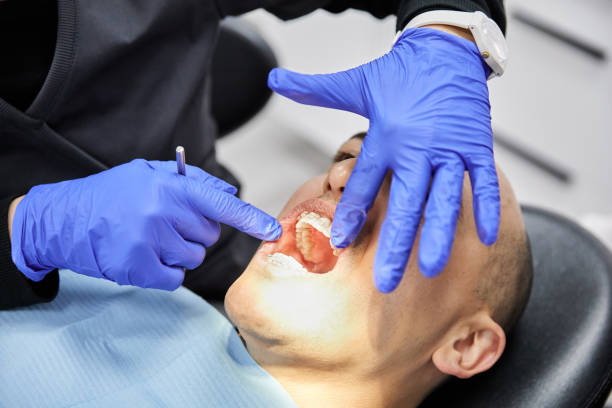 Best Emergency Wisdom Teeth Removal in Mountain Brook, AL